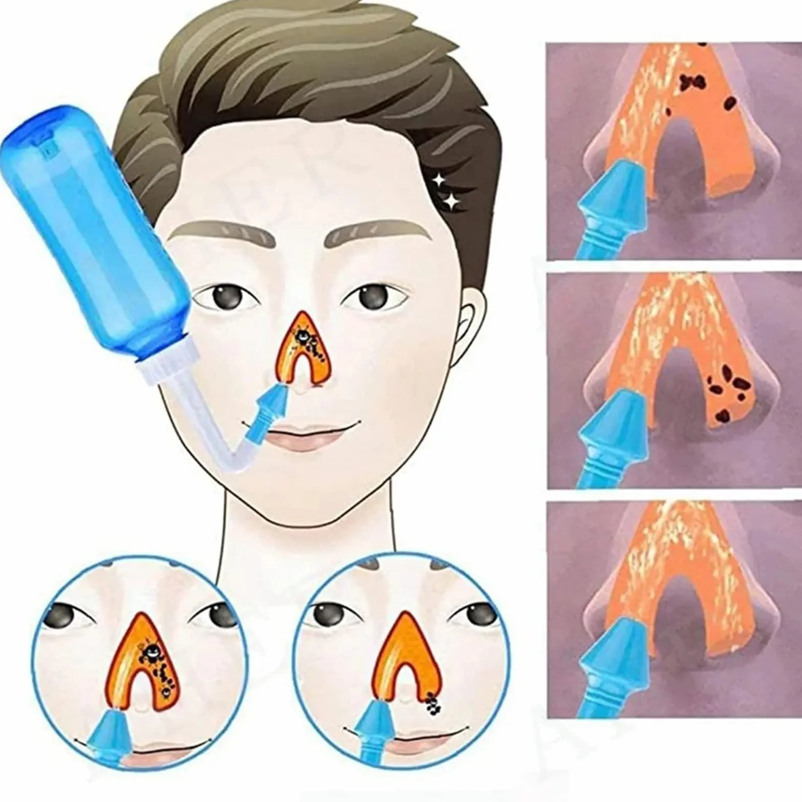 Neti Pot, zestaw do płukania nosa do mycia nosa, butelka do płukania nosa 300 ml środek do czyszczenia nosa do systemu nawadniania nosa dla dzieci dorosłych