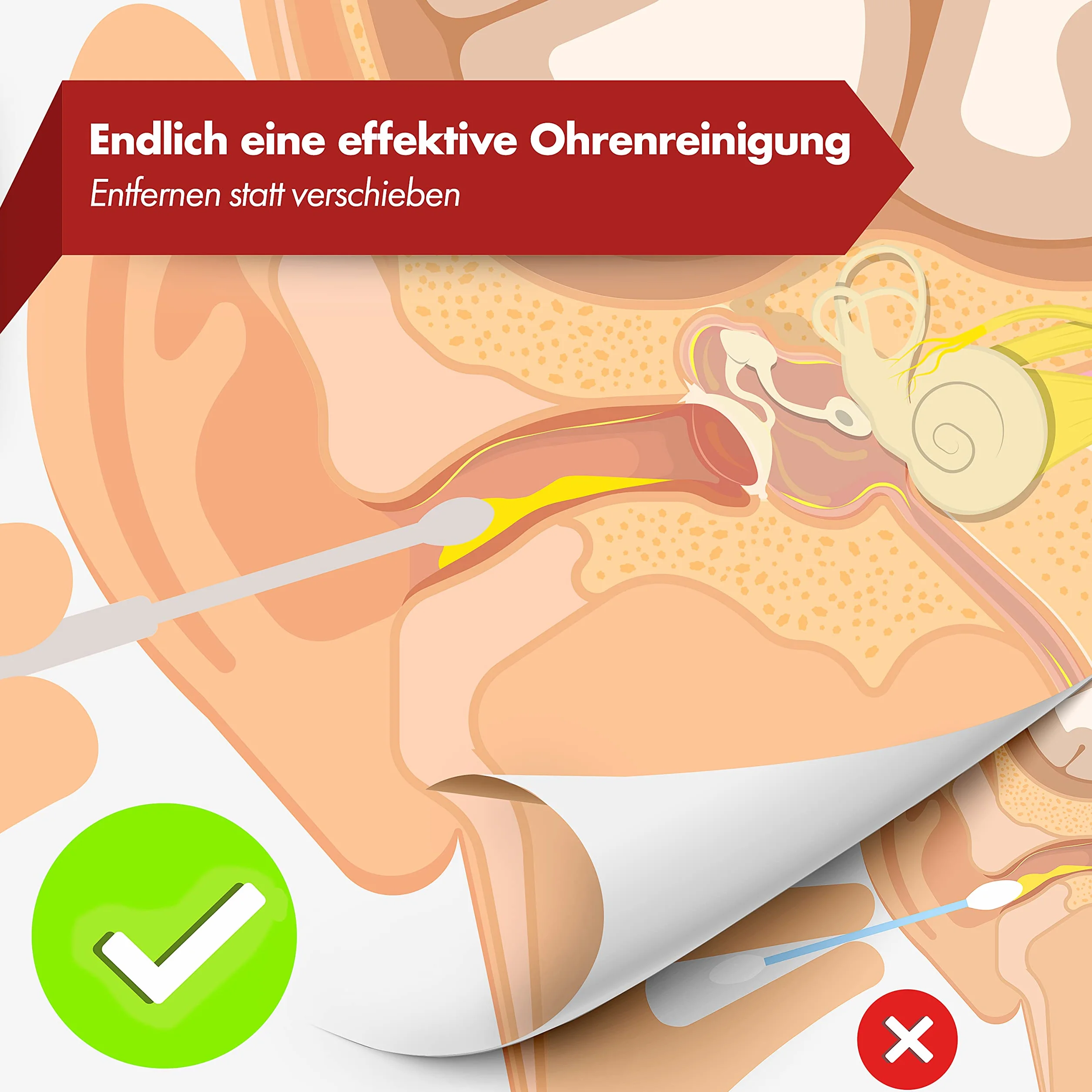 NEUMANN® Zestaw do czyszczenia uszu wielokrotnego użytku – stal nierdzewna – poręczne pudełko do przechowywania (pętla, spirala i łyżka w kształcie łyżki), wysokiej jakości środek do usuwania